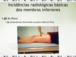 Incidências radiológicas básicas
dos membros inferiores
AP
AP do fêmur
RC
RC perpendicular direcionado ao ponto médio do filme.
 