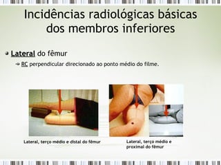 Incidências radiológicas básicas
dos membros inferiores
Lateral
Lateral do fêmur
RC
RC perpendicular direcionado ao ponto médio do filme.
Lateral, terço médio e distal do fêmur Lateral, terço médio e
proximal do fêmur
 