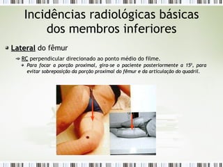 Incidências radiológicas básicas
dos membros inferiores
Lateral
Lateral do fêmur
RC
RC perpendicular direcionado ao ponto médio do filme.
Para focar a porção proximal, gira-se o paciente posteriormente a 15
Para focar a porção proximal, gira-se o paciente posteriormente a 150
0
, para
, para
evitar sobreposição da porção proximal do fêmur e da articulação do quadril.
evitar sobreposição da porção proximal do fêmur e da articulação do quadril.
 