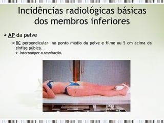 Incidências radiológicas básicas
dos membros inferiores
AP
AP da pelve
RC
RC perpendicular no ponto médio da pelve e filme ou 5 cm acima da
sínfise púbica.
Interromper a respiração.
Interromper a respiração.
 