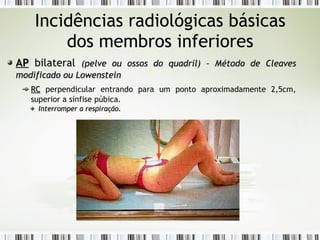 Incidências radiológicas básicas
dos membros inferiores
AP
AP bilateral (pelve ou ossos do quadril) – Método de
(pelve ou ossos do quadril) – Método de Cleaves
Cleaves
modificado ou Lowenstein
modificado ou Lowenstein
RC
RC perpendicular entrando para um ponto aproximadamente 2,5cm,
superior a sínfise púbica.
Interromper a respiração.
Interromper a respiração.
 