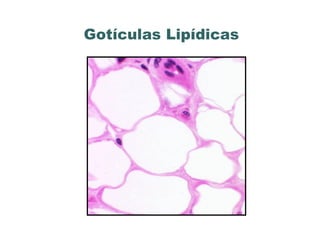 Gotículas Lipídicas
 