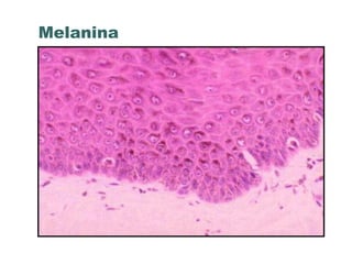 Melanina
 