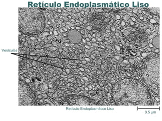 www.portaldasaulas.com.br Vesículas 0.5   m  Retículo Endoplasmático Liso Retículo Endoplasmático Liso  