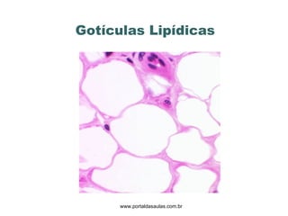 Gotículas Lipídicas www.portaldasaulas.com.br 