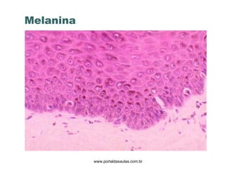 Melanina www.portaldasaulas.com.br 