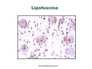 Lipofuscina www.portaldasaulas.com.br 