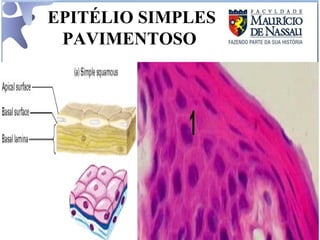 EPITÉLIO SIMPLES PAVIMENTOSO  