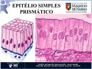 EPITÉLIO SIMPLES PRISMÁTICO 