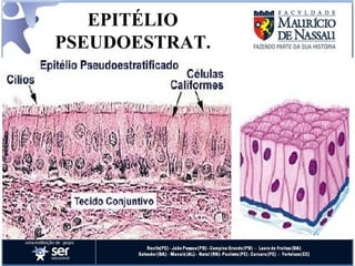 EPITÉLIO PSEUDOESTRAT. 