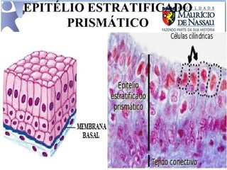 EPITÉLIO ESTRATIFICADO PRISMÁTICO 