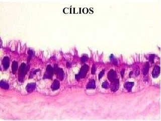 CÍLIOS 