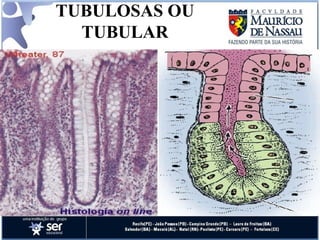 TUBULOSAS OU TUBULAR 