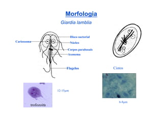 Morfologia
                       Giardia lamblia


                                Disco suctorial
Cariossoma                      Núcleo

                            Corpos parabasais
                            Axonema



                           Flagelos               Cistos




                      12-15µm


                                                     6-8µm
         trofozoita
 