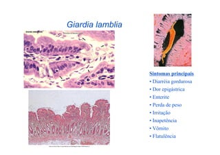 Giardia lamblia




                  Sintomas principais
                  •  Diarréia gordurosa
                  •  Dor epigástrica
                  •  Enterite
                  •  Perda de peso
                  •  Irritação
                  •  Inapetência
                  •  Vômito
                  •  Flatulência
 