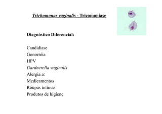 Trichomonas vaginalis - Tricomoníase



Diagnóstico Diferencial:

Candidíase
Gonorréia
HPV
Gardnerella vaginalis
Alergia a:
Medicamentos
Roupas íntimas
Produtos de higiene
 
