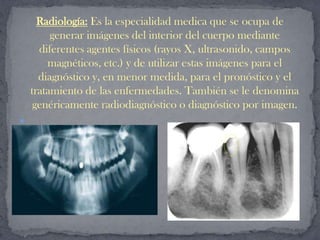 Odontología Preventiva: Es el estudio o la ciencia que se
encarga de la promoción de la salud bucodental para evitar
 prob...
