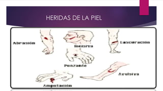 HERIDAS DE LA PIEL
 