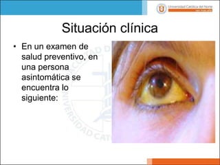 Situación clínica
• En un examen de
salud preventivo, en
una persona
asintomática se
encuentra lo
siguiente:
 