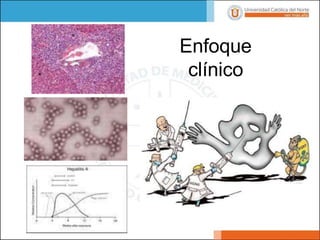 Enfoque
clínico
 
