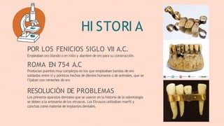 HI STORI A
POR LOS FENICIOS SIGLO VII A.C.
Empleaban oro blando o en rollo y alambre de oro para su construcción.
ROMA EN 754 A.C
Producían puentes muy complejos en los que empleaban bandas de oro
soldadas entre sí y pónticos hechos de dientes humanos o de animales, que se
fijaban con remaches deoro
RESOLUCIÓN DE PROBLEMAS
Los primeros aparatos dentales que se usaron en la historia de la odontología
se deben a la artesanía delos etruscos. Los Etruscos utilizaban marfil y
conchas como material de implantes dentales.
 