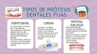TIPOS DE PRÓTESIS
DENTALES FIJAS
PUENTEDENTAL CORONA PRÓTESIS
Serecurrepara restaurar
dos o más dientes.
Para colocarlo,el dentista
deberá tallar los dos
dientes adyacentes a la
pieza dental dañada o
perdida.
Deesta manera,reducesu
volumen y crea el espacio
necesario para colocar el
puente.
La corona -también
llamada coloquialmente
funda- es un tipo de
prótesis dental fija al que
serecurrecuando es un
solo dienteel queestá
dañado.
tiene
C
co
O
mo
M
ob
P
je
L
tiv
E
o
TA
sustituir por completo la
arcada superior y/o inferior
dela boca.
Estas sesustentan sobreel
paladar y la mucosa dela
boca,y es por ello por lo
quesellaman
mucosoportadas
 