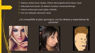  Explorar ambas fosas nasales. Utilizar descongestionante tópico nasal 
 Adecuada iluminación. Se deberá visualizar coana/nasofaringe 
 Valorar endoscopia nasal rígida o flexible 
 Una vez realizada valoración nasal: 
¿ Es compatible el plan quirúrgico con los deseos y expectativas de 
paciente? 
 