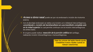 Acceso a dorso nasal , puede ser por via endonasal o incisión de rinotomia 
externa 
 Con el abordaje endonasal, se realiza una incisión uni o bilateral intercartilaginosa, 
convirtiendo la incisión de hemitransfixion en una transfixión completa solo 
en la mitad superior , lo cual permite continuar con la incisión intercartilaginosa 
de ambos lados. 
 El cirujano puede realizar resección de la porción cefálica del cartílago, 
realizando incisión intracartilaginosa o transcartilaginosa. 
Dejar las uniones del tejido blando ayuda 
a estabilizar huesos nasales cuando se 
realizan osteotomías. 
 