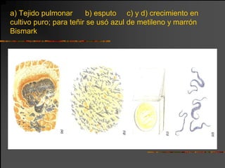 a) Tejido pulmonar      b) esputo c) y d) crecimiento en
cultivo puro; para teñir se usó azul de metileno y marrón
Bismark
 