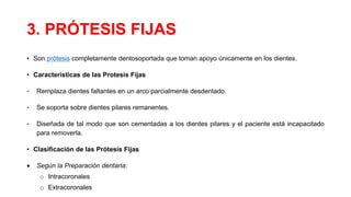 3. PRÓTESIS FIJAS
• Son prótesis completamente dentosoportada que toman apoyo únicamente en los dientes.
• Caracteristicas de las Protesis Fijas
- Remplaza dientes faltantes en un arco parcialmente desdentado.
- Se soporta sobre dientes pilares remanentes.
- Diseñada de tal modo que son cementadas a los dientes pilares y el paciente está incapacitado
para removerla.
• Clasificación de las Prótesis Fijas
 Según la Preparación dentaria:
o Intracoronales
o Extracoronales
 