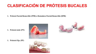 CLASIFICACIÓN DE PRÓTESIS BUCALES
1. Prótesis Parcial Removible (PPR) o Dentadura Parcial Removible (DPR)
1. Prótesis total. (PT)
1. Prótesis Fija. (PF)
 
