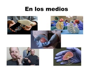 En los medios
 