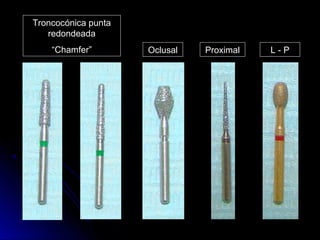 Troncocónica punta
   redondeada
    “Chamfer”        Oclusal   Proximal   L-P
 