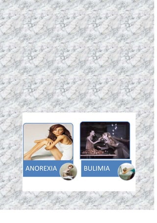 ANOREXIA   BULIMIA
 