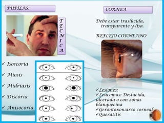 PUPILAS:

CORNEA
T
E
C
N
I
C
A

Debe estar traslúcida,
transparente y lisa.

REFLEJO CORNEANO

 Isoscoria
 Miosis
 Midriasis
 Discoria

 Anisocoria

Lesiones:
Leucomas: Deslucida,
ulcerada o con zonas
blanquecina
Gerontoxon:arco corneal
Queratitis

 