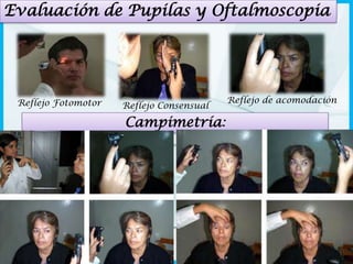 Evaluación de Pupilas y Oftalmoscopia

Reflejo Fotomotor

Reflejo Consensual

Campimetría:

Reflejo de acomodación

 