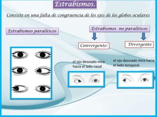 Estrabismos.
Consiste en una falta de congruencia de los ejes de los globos oculares

Estrabismos paralíticos

Estrabismos no paralíticos

Convergente:

el ojo desviado mira
hacia el lado nasal

Divergente

el ojo desviado mira hacia
el lado temporal

 