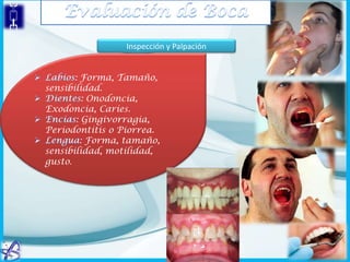 Inspección y Palpación
: Forma, Tamaño,
sensibilidad.
: Onodoncia,
Exodoncia, Caries.
: Gingivorragia,
Periodontitis o Piorrea.
: Forma, tamaño,
sensibilidad, motilidad,
gusto.

 