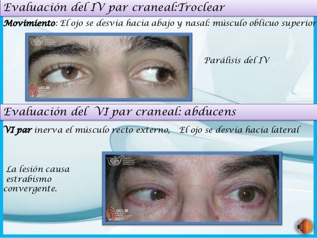 examen fisico de cabeza