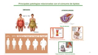 Principales patologías relacionadas con el consumo de lípidos
OBESIDAD ATEROSCLEROSIS
Placa de ateroma
Enfermedad vascular periférica Accidente vascular cerebral
Angina de pecho / Infarto de miocardio
12
 
