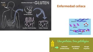 17
Enfermedad celiaca
 