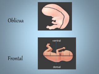 Oblicua
Frontal
 