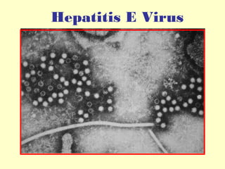 Hepatitis E Virus

 
