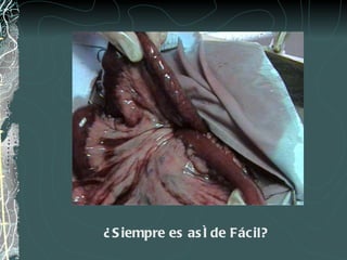 ¿Siempre es así de Fácil? 