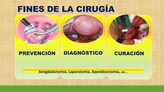 FINES DE LA CIRUGÍA
PREVENCIÓN DIAGNÓSTICO CURACIÓN
Amigdalectomía, Laparatomía, Apendicectomía, etc...
 