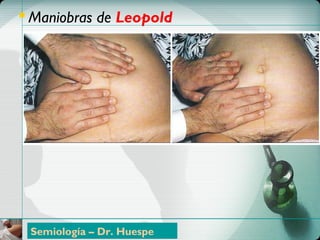 ControlControl PrenatalPrenatal
 Maniobras de Leopold
Semiología – Dr. Huespe
 