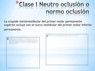 *

La cúspide mesiovestibular del primer molar permanente
superior ocluye con el surco vestibular del primer molar inferior
permanente.
 