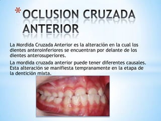 *
La Mordida Cruzada Anterior es la alteración en la cual los
dientes anteroinferiores se encuentran por delante de los
dientes anterosuperiores.
La mordida cruzada anterior puede tener diferentes causales.
Esta alteración se manifiesta tempranamente en la etapa de
la dentición mixta.
 