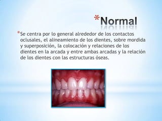 *
* Se centra por lo general alrededor de los contactos
 oclusales, el alineamiento de los dientes, sobre mordida
 y superposición, la colocación y relaciones de los
 dientes en la arcada y entre ambas arcadas y la relación
 de los dientes con las estructuras óseas.
 