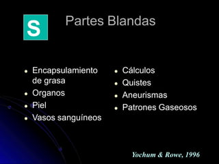 Partes Blandas
● Encapsulamiento
de grasa
● Organos
● Piel
● Vasos sanguíneos
● Cálculos
● Quistes
● Aneurismas
● Patrones Gaseosos
S
Yochum & Rowe, 1996
 